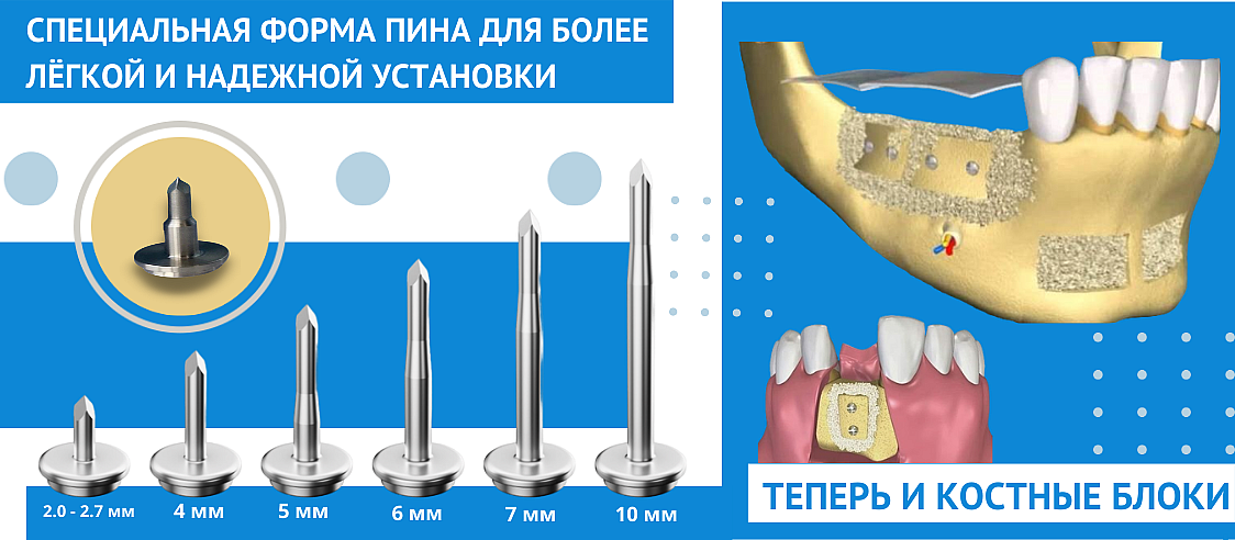 piny-bezudarnie-kupit-2
